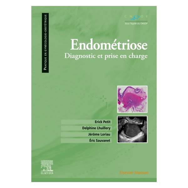 Endométriose