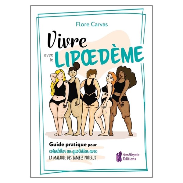 Vivre avec le lipoedème : guide pratique pour cohabiter au quotidien avec la maladie des jambes poteaux